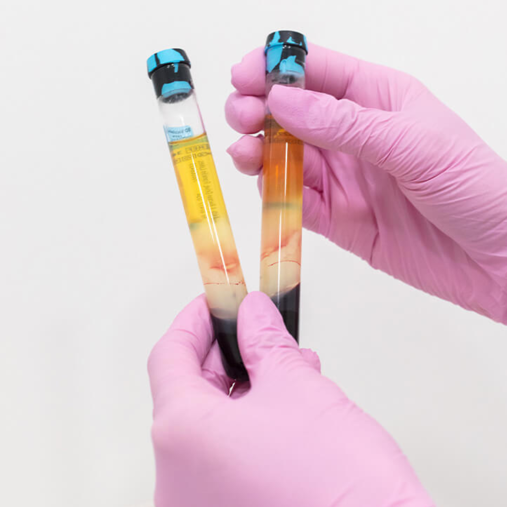 PRP Plasma 1000x1000